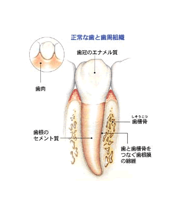 歯周病はなぜ起こるのか？